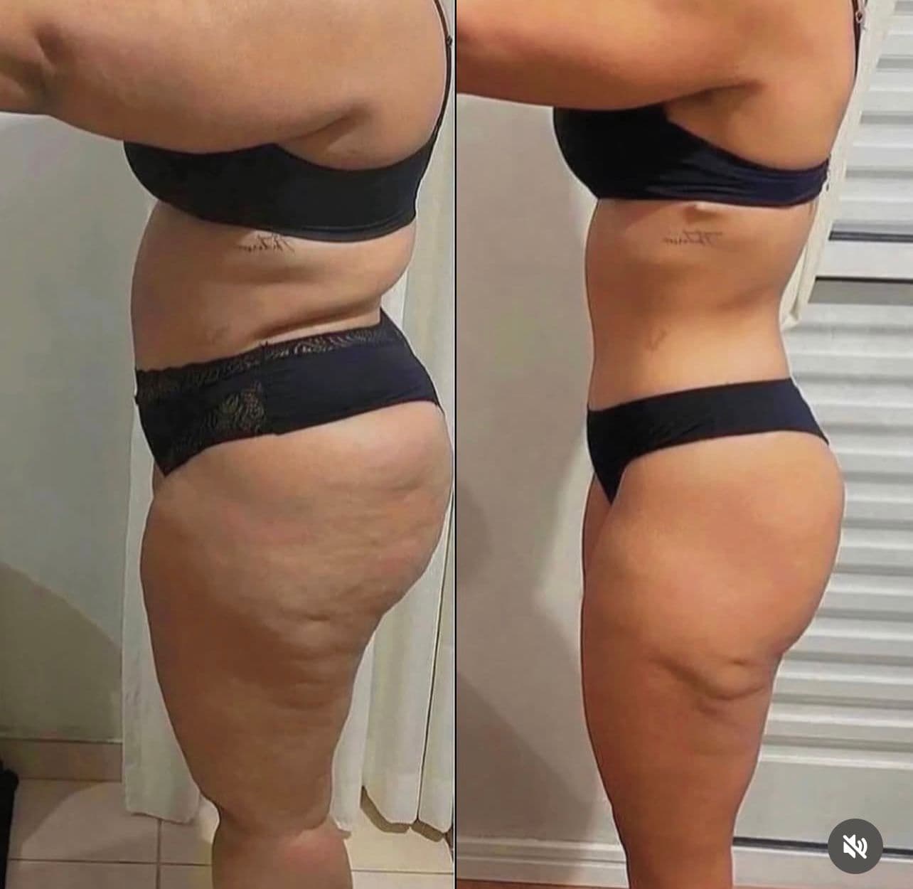 Transformação: Remodelagem Completa