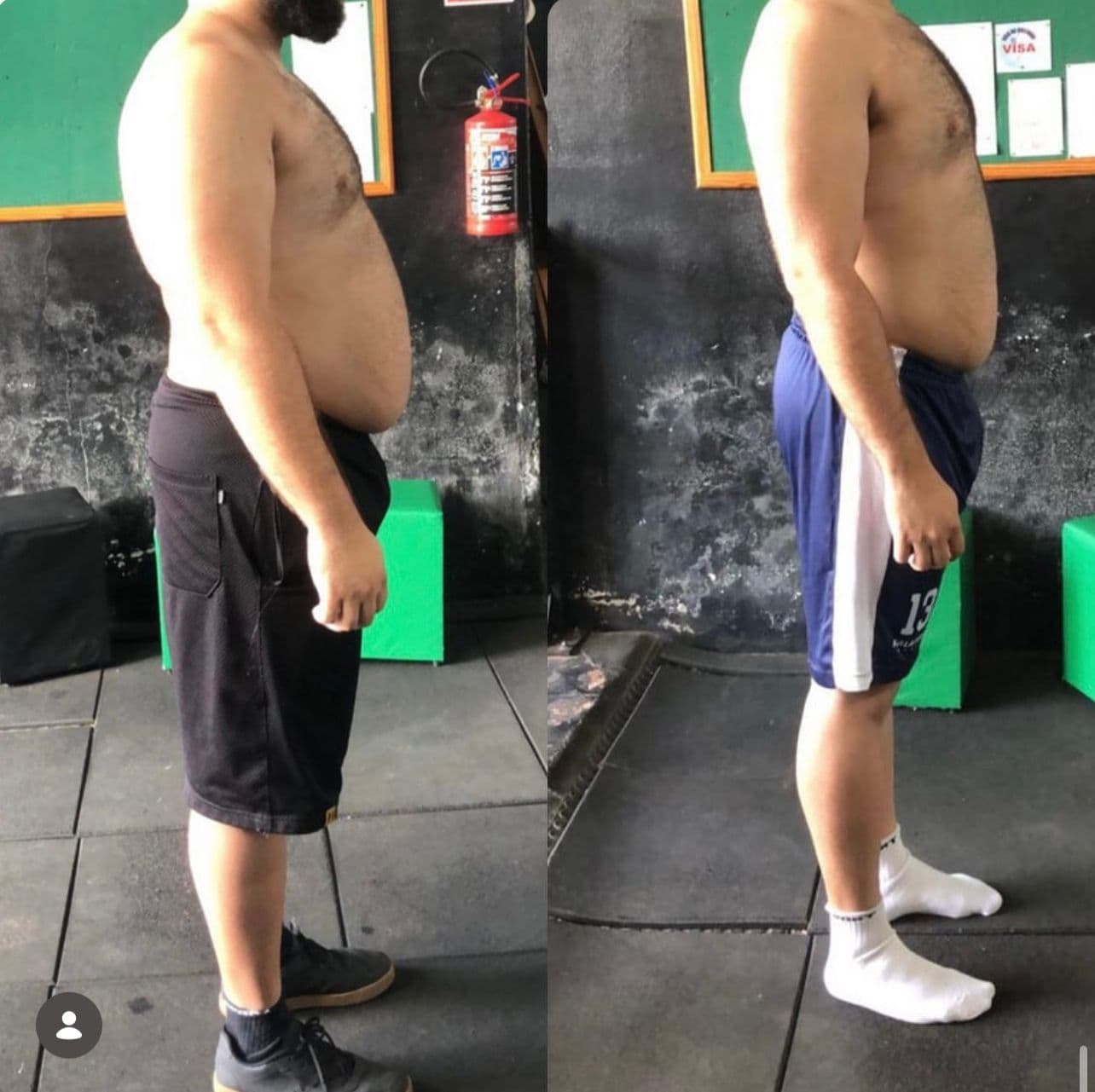 Transformação: Redução Abdominal