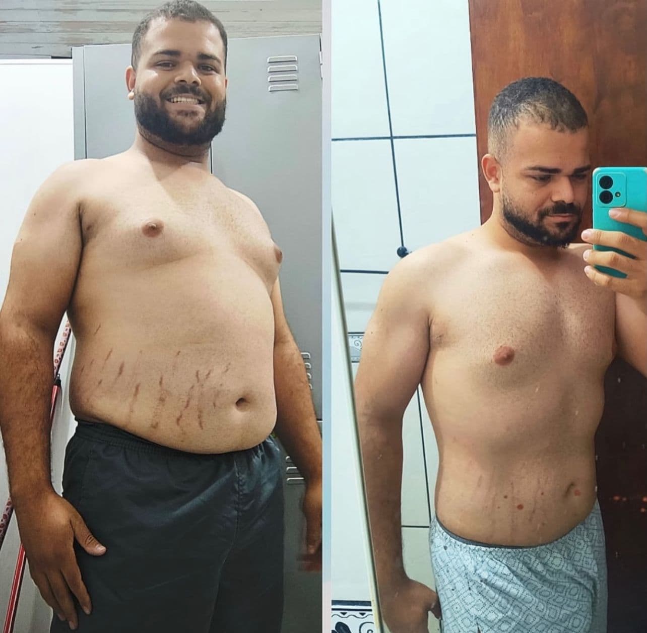 Transformação: Emagrecimento Real