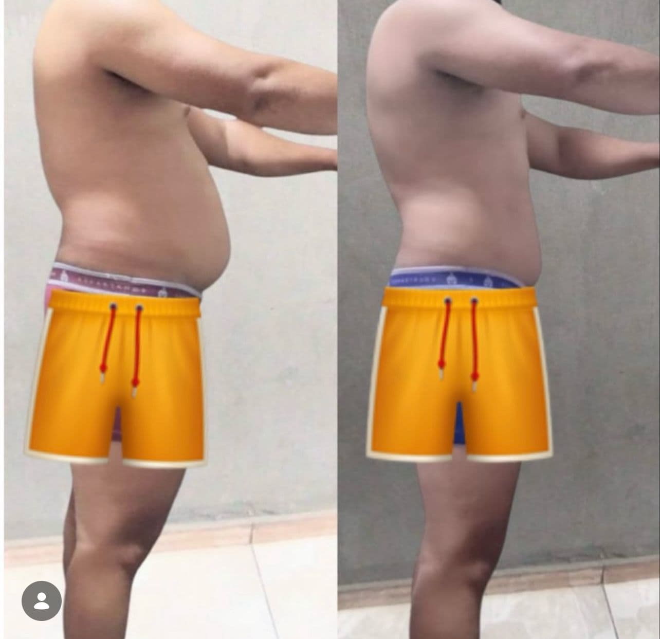 Transformação: Barriga Zerada